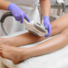 Laser Hair Removal Service: Cost and Side Effects